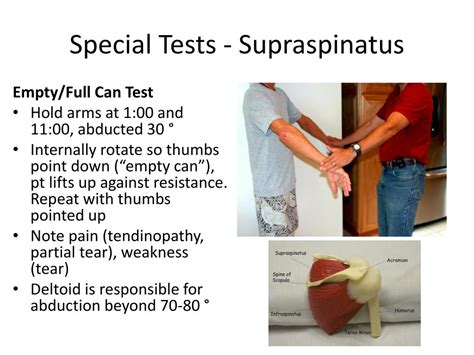 supraspinatus test results